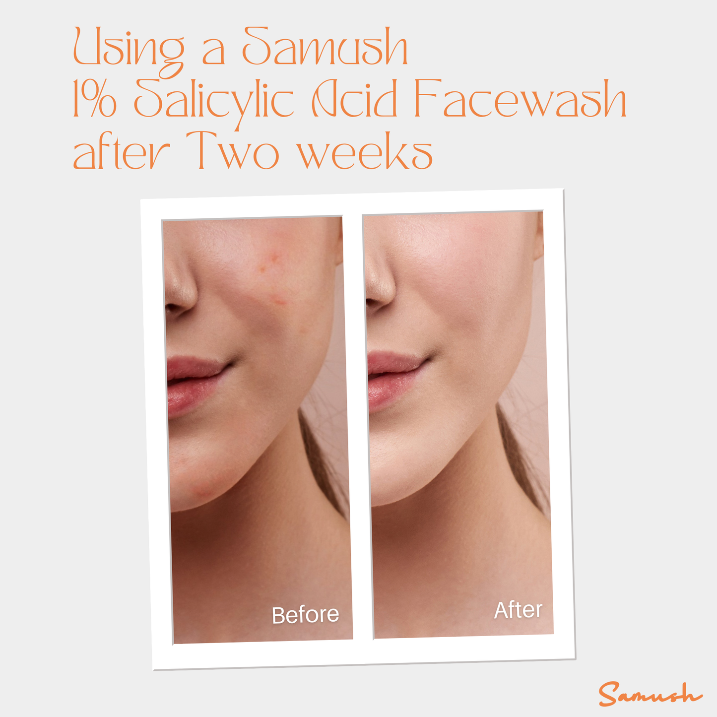 Samush Herbal 1% Salicylic Acid Facewash